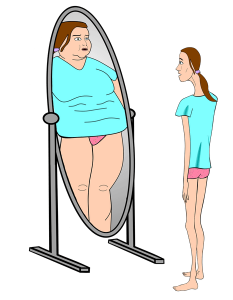 Ayuda Para la Anorexia